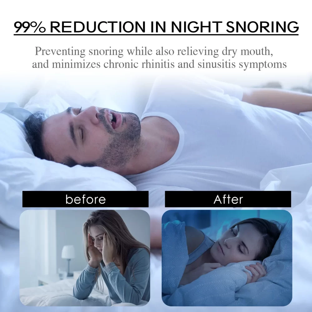 Anti Snoring Sticker Promote Better Sleep Improve Mouth Breathing Reduce Snore Nighttime Sleep Mouth Correction Tape For Adult - Image 3